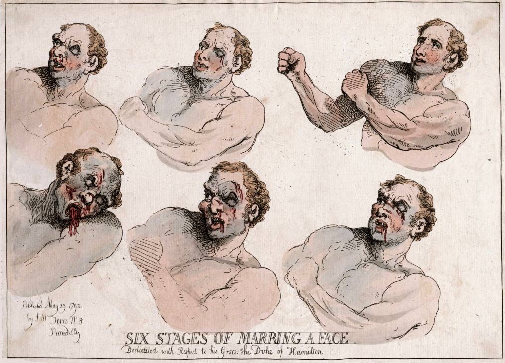 Rowlandson, Six stages of marring a face, 1794